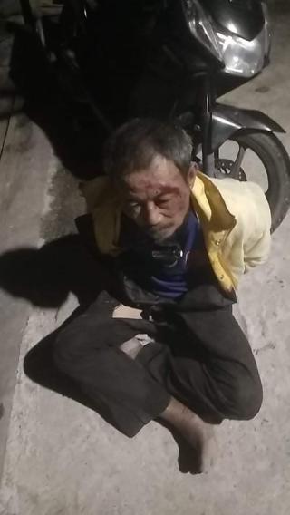 Diduga Dibalik Kasus Pengeroyokan ada Oknum Ormas,Korban Minta Laporannya Ditindaklanjuti Polesek Ru